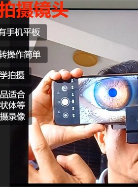 手机外置高清镜头眼睛眼球晶状体医疗检测拍摄录像微距放大摄像头