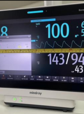 适用于mindray迈瑞BeneVision N15平板高清防刮花膜 软钢化防爆膜