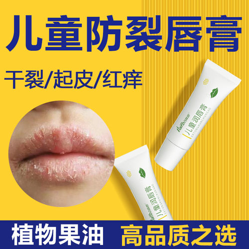 儿童唇膏，嘴唇防干裂起皮！