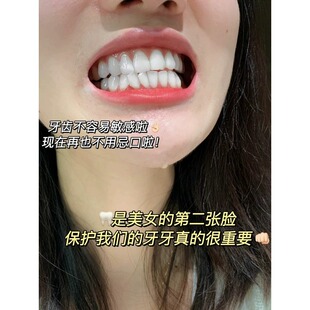 脱敏专用牙膏抗敏美白去口臭官方保正品正品牙齿酸软抗过敏防发酸