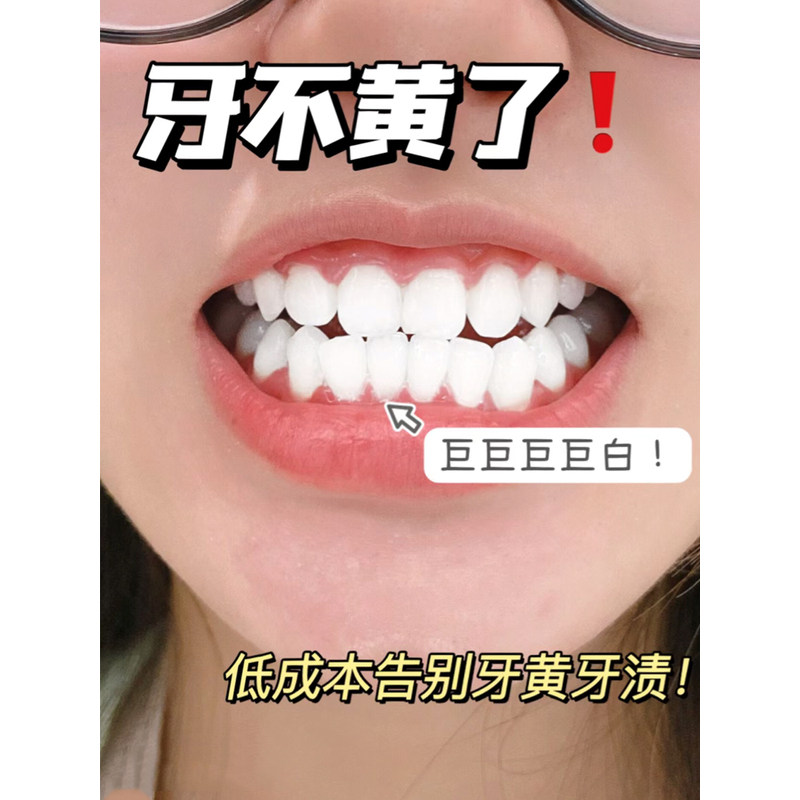 牙齿美白 速效 黄牙去黄牙齿神器牙白牙黄美白洗牙齿污垢除牙石洗