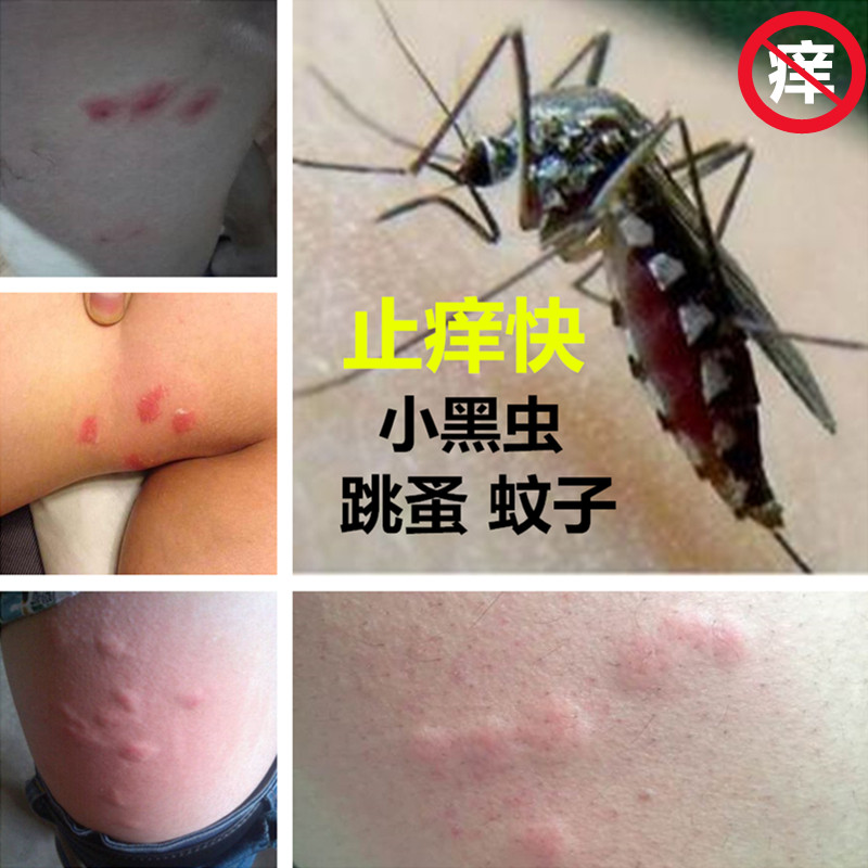 祚旭堂跳蚤咬止痒膏儿童蚊子虫叮咬成人跳蚤叮咬红肿皮肤止奇痒霜
