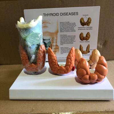 供应教学模型 甲状腺病变模型 解剖模型 医学教材模型 医疗礼品
