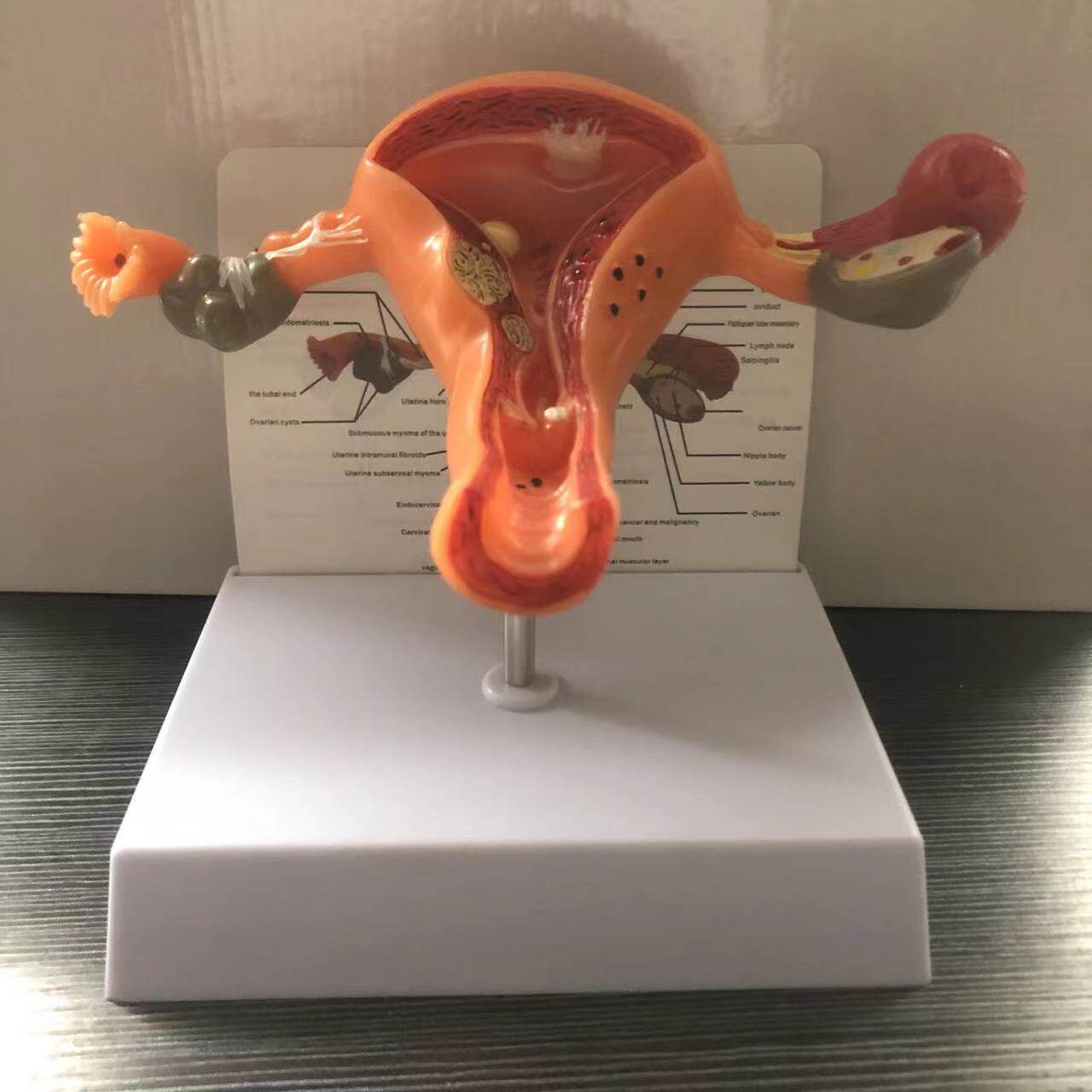 供应人体子宫模型教具阴道卵巢解剖病理医学女性仿真女性生殖模型