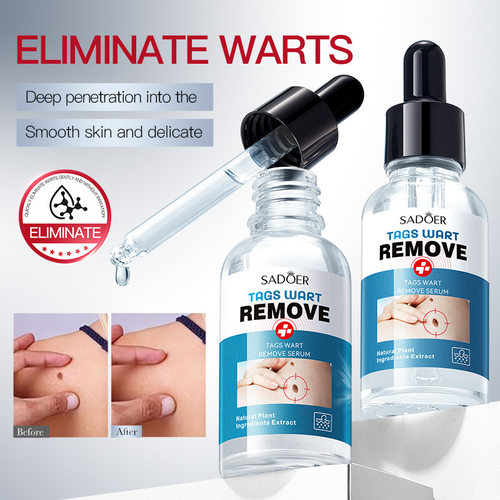 All essence SADOER wart essence can smooth skin, face and b