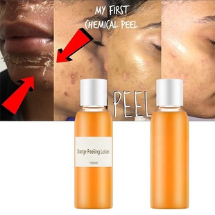 Removing Dead Whitening Skin Effective Orange Strong Lotion