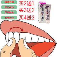 口益清舒康宁防松固齿牙膏强健牙龈牙齿松动修护出血固定买2送1