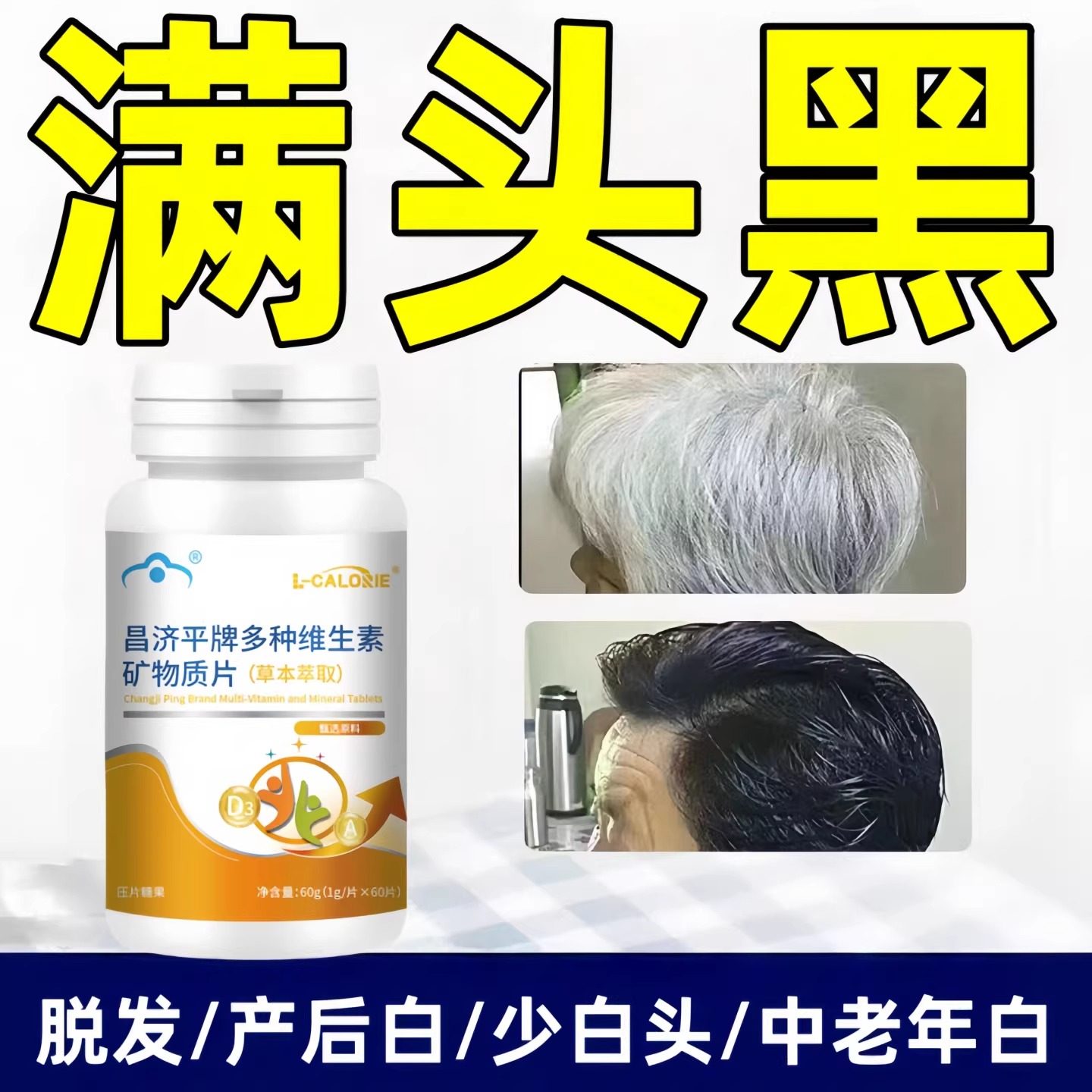 艾弗维生素B族乌发素复合维生素白发脱发生物素黑发养发男女正品,传统滋补营养品,其他药食同源食品,淘宝优惠券,粉丝福利购,淘宝优惠卷