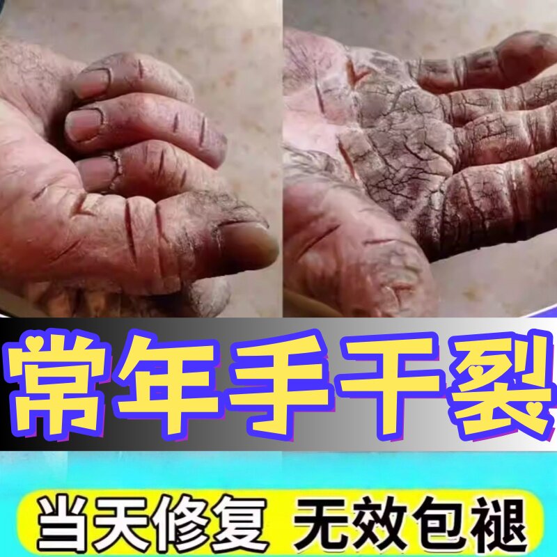 正品五毒愈合灵手脱皮专用修复霜护手霜