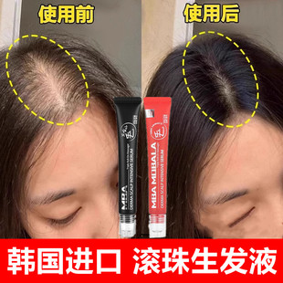 韩国mba生发液滚珠增发密发际线毛囊头发生长精华液男女进口正品