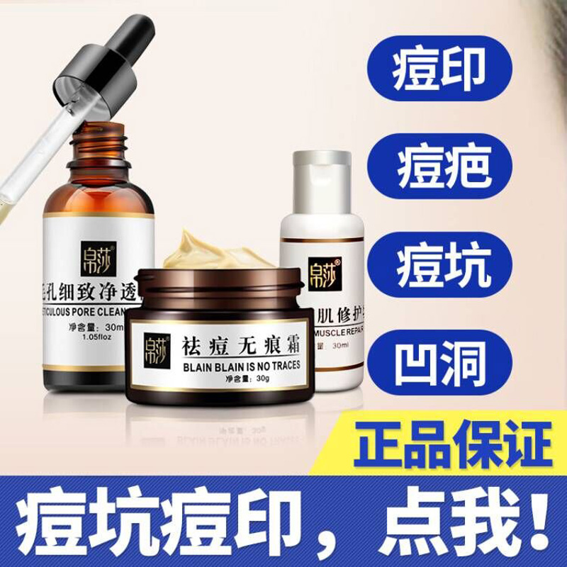 去臉部痘痘印粉刺男士女面部修復無痕痘疤祛痘印膏凹洞痘坑霜淡化