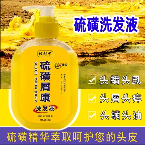 祖郎中正品硫磺去屑洗发水头痒油