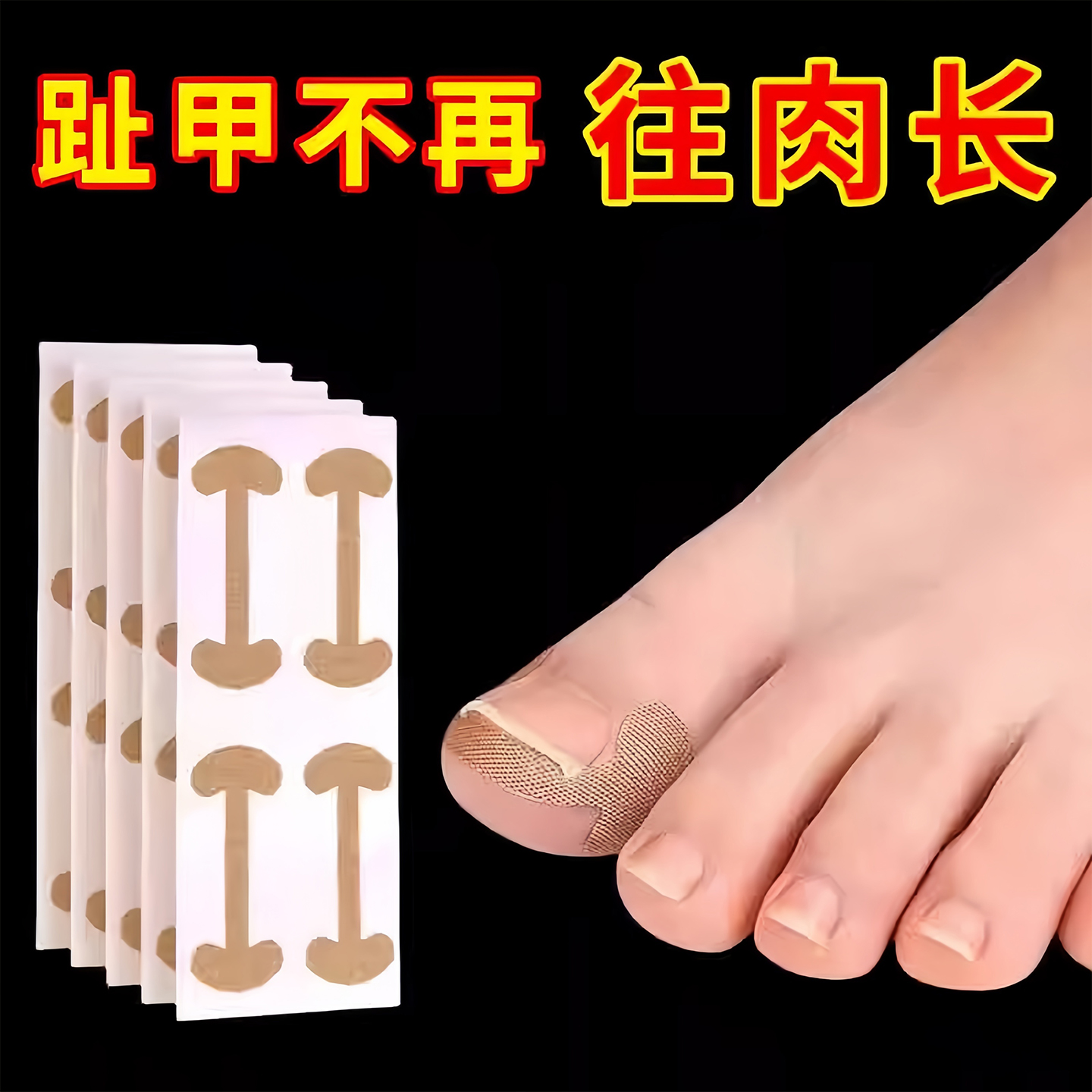 甲沟神器指甲矫正器隔离趾嵌肉甲