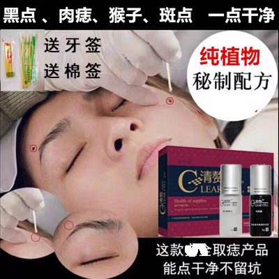 清赘去痦子药水点志膏无痕正品点斑跖尤猴子小肉粒疙瘩刺瘊子丝尤