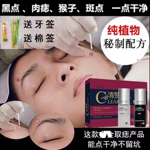 清赘去痦子药水点志膏无痕正品点斑跖尤瘊子小肉粒疙瘩刺瘊子丝尤