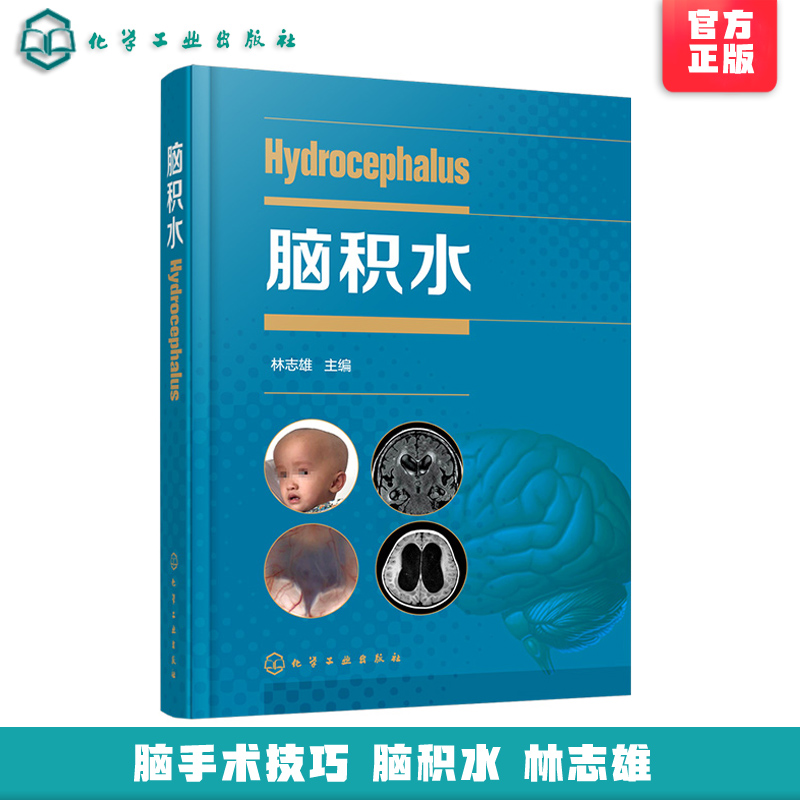 脑积水 林志雄 脑手术技巧周良辅赵继宗王忠诚 神经外科颅底手术入路 显微外科神经内镜 神经外科学书籍  脑血管 脑外科颅脑损伤