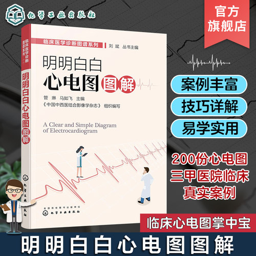 明明白白心电图图解临床医学诊断