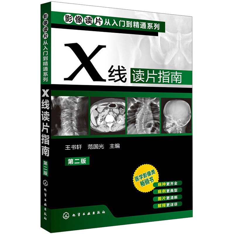 正版现货 X线读片指南 2非第3版(三版)临床医学影像诊断学丛书 x线检查书籍 鉴别诊断图书 放射诊断学系列 陈明 影像学诊断图谱
