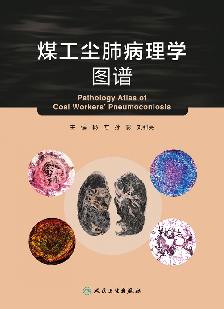 煤工尘肺病理学图谱 博库网