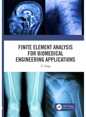 TF Finite Element Analysis for Biomedical Engineering Applic