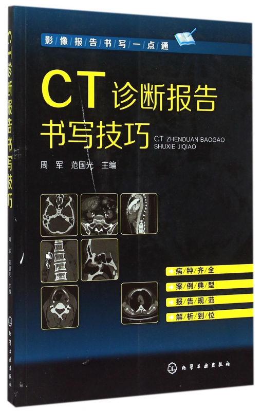 影像报告书写一点通 CT诊断报告书写技巧 CT图谱大全 医学影像报告书写一点通 看片读片指南 新手学拍片教程 医学影像技术应用书籍