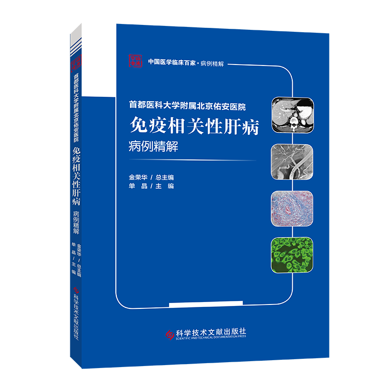 首都医科大学附属北京佑安医院免疫相关性肝病病例精解/中国医学临床百家 博库网