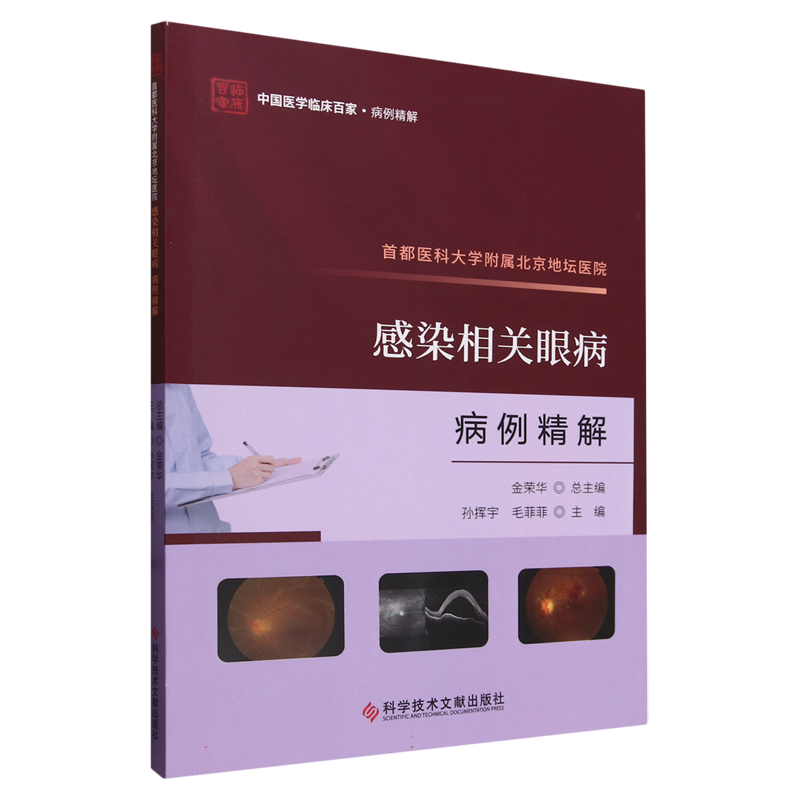 首都医科大学附属北京地坛医院感染相关眼病病例精解 博库网