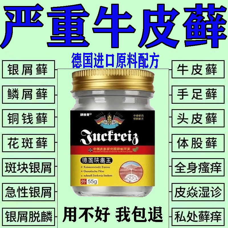 包冶好(进口强效配方)牛皮藓膏