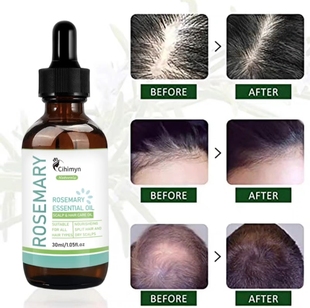 Rosemary Essential Oil 迷迭香护发精油养护头皮 素野