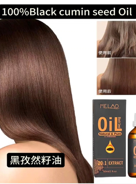 Black cumin seed Oil  hair oil土耳其黑孜然籽油护发精油