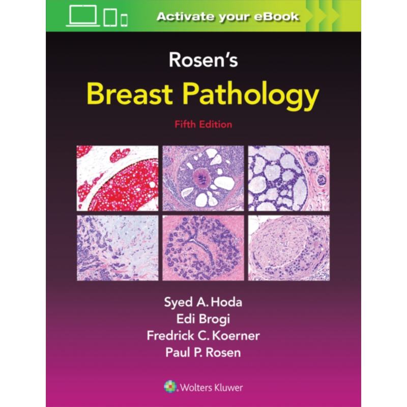 现货 Rosen乳腺病理学 第5版 Rosen s Breast Pathology 英文原版 Syed A Hoda Doody 医学 医疗 肿瘤【中商原版】