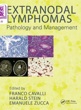 海外直订医药图书Extranodal Lymphomas: Pathology and Management