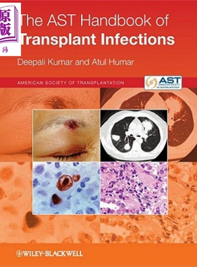 现货 移植感染AST手册 第2版 The Ast Handbook Of Transplant Infections 英文原版 Deepali Kumar Atul Humar【中商原版】