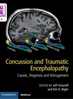 海外直订医药图书Concussion and Traumatic Encephalopathy: Causes, Diagnosis and Management 脑震荡和创伤性脑病:原因、