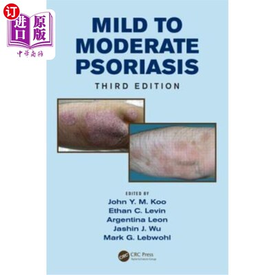 海外直订医药图书Mild to Moderate Psoriasis 轻度至中度牛皮癣