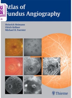 海外直订医药图书Atlas of Fundus Angiography 眼底血管造影图