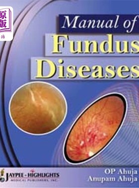 海外直订医药图书Manual of Fundus Diseases 眼底疾病手册