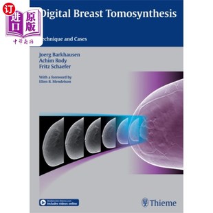 Tomosynthesis Breast 数字乳腺Tomosynthesis Digital 海外直订医药图书古英语