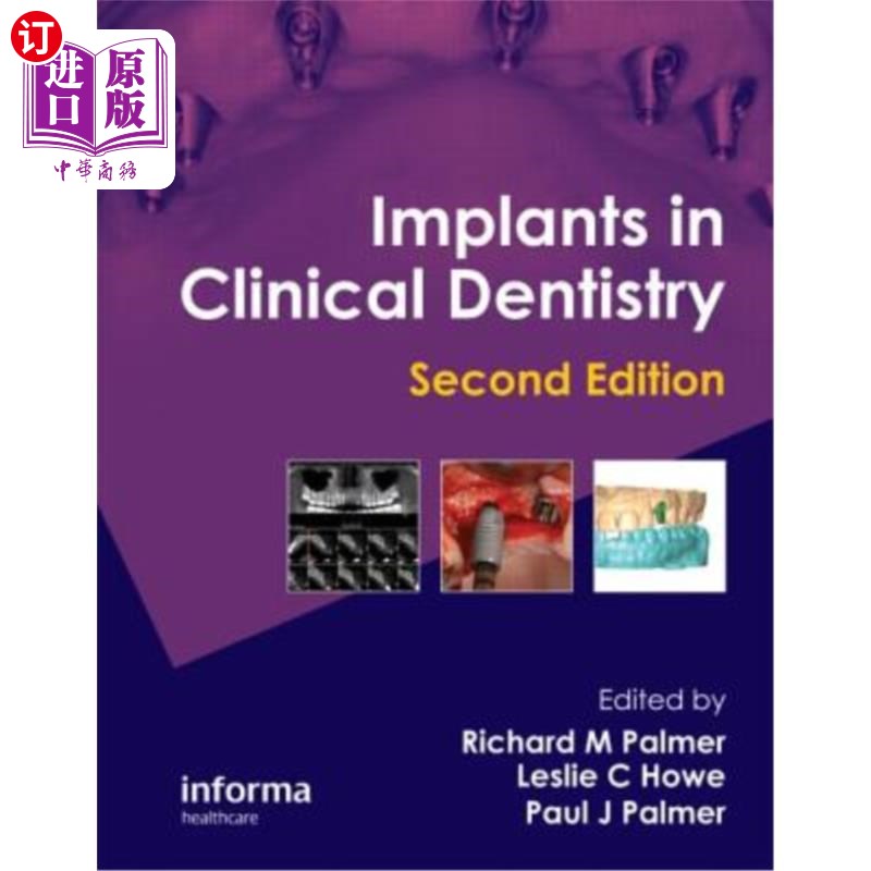 海外直订医药图书Implants in Clinical Dentistry 临床牙科学中的植入物
