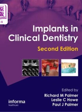 海外直订医药图书Implants in Clinical Dentistry 临床牙科学中的植入物