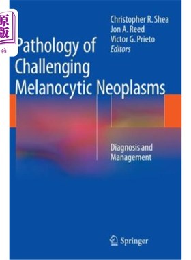海外直订医药图书Pathology of Challenging Melanocytic Neoplasms: Diagnosis and Management 挑战性黑色素细胞瘤的病理学