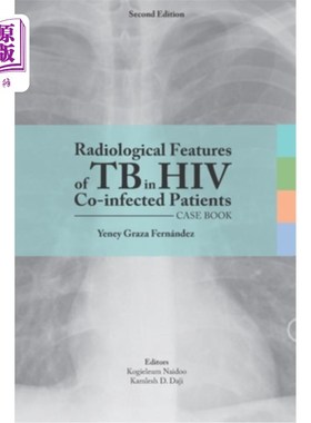 海外直订医药图书Radiological features of TB in HIV Co-infected Patients. Case book HIV合并感染患者结核的放射学特征
