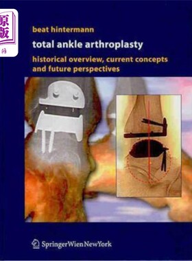 海外直订医药图书Total Ankle Arthroplasty: Historical Overview, Current Concepts and Future Persp 全踝关节置换术:历