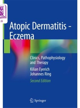 海外直订医药图书古英语 Atopic Dermatitis - Eczema 特应性皮炎-湿疹