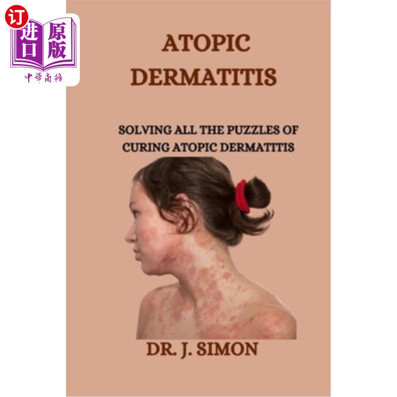 海外直订医药图书Atopic Dermatitis: Solving All the Puzzles of Curing Atopic Dermatitis 特应性皮炎：解决治疗特应性皮