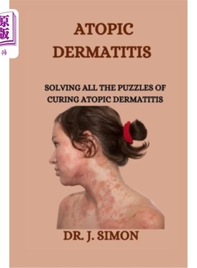 海外直订医药图书Atopic Dermatitis: Solving All the Puzzles of Curing Atopic Dermatitis 特应性皮炎：解决治疗特应性皮