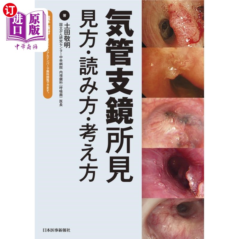 海外直订日语 気管支鏡所見　見方・読み方・考え方 支气管镜观察方法、读法、思考方法