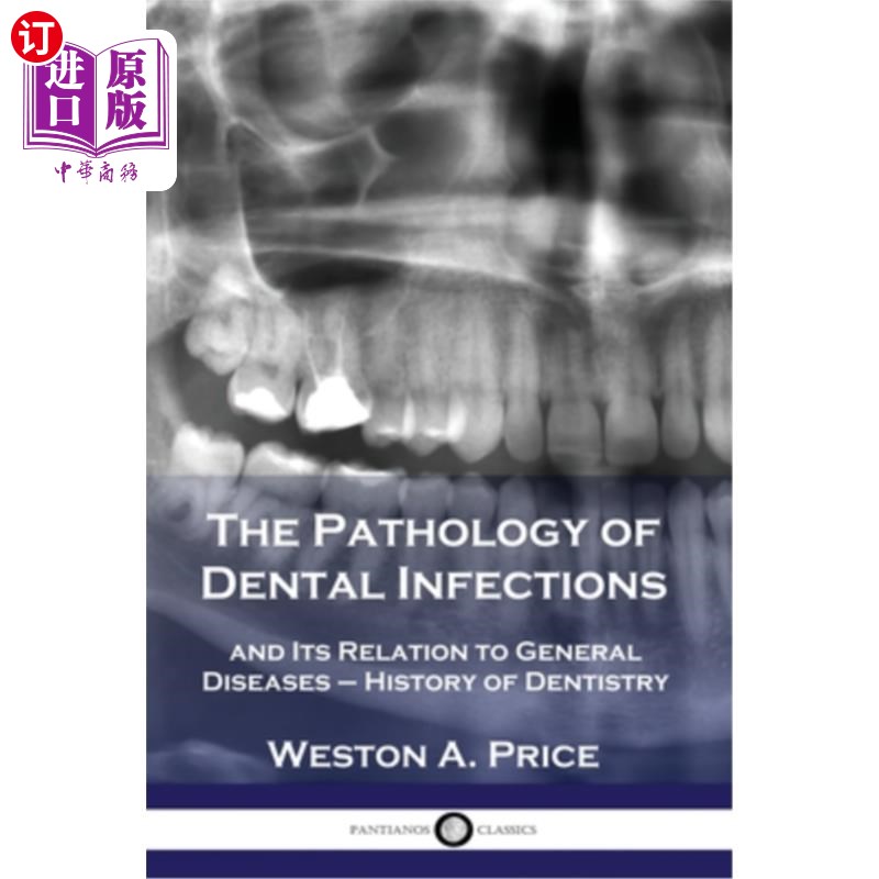 海外直订医药图书The Pathology of Dental Infections: and Its Relation to General Diseases- Histo口腔感染病理学:及