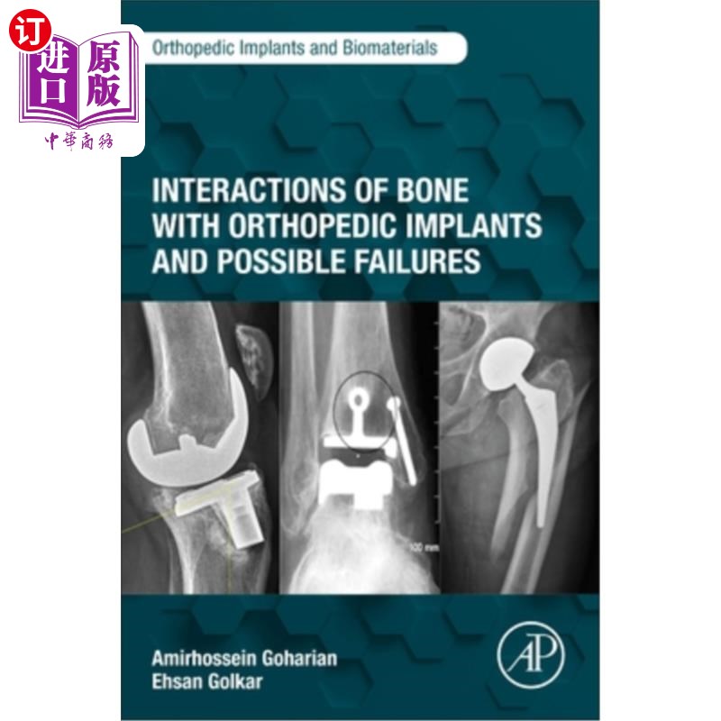 海外直订Interactions of Bone with Orthopedic Implants and Possible Failures 骨与骨科植入物的相互作用及可能的失败