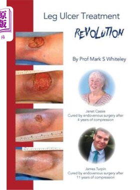海外直订医药图书Leg Ulcer Treatment Revolution 腿部溃疡的治疗革命